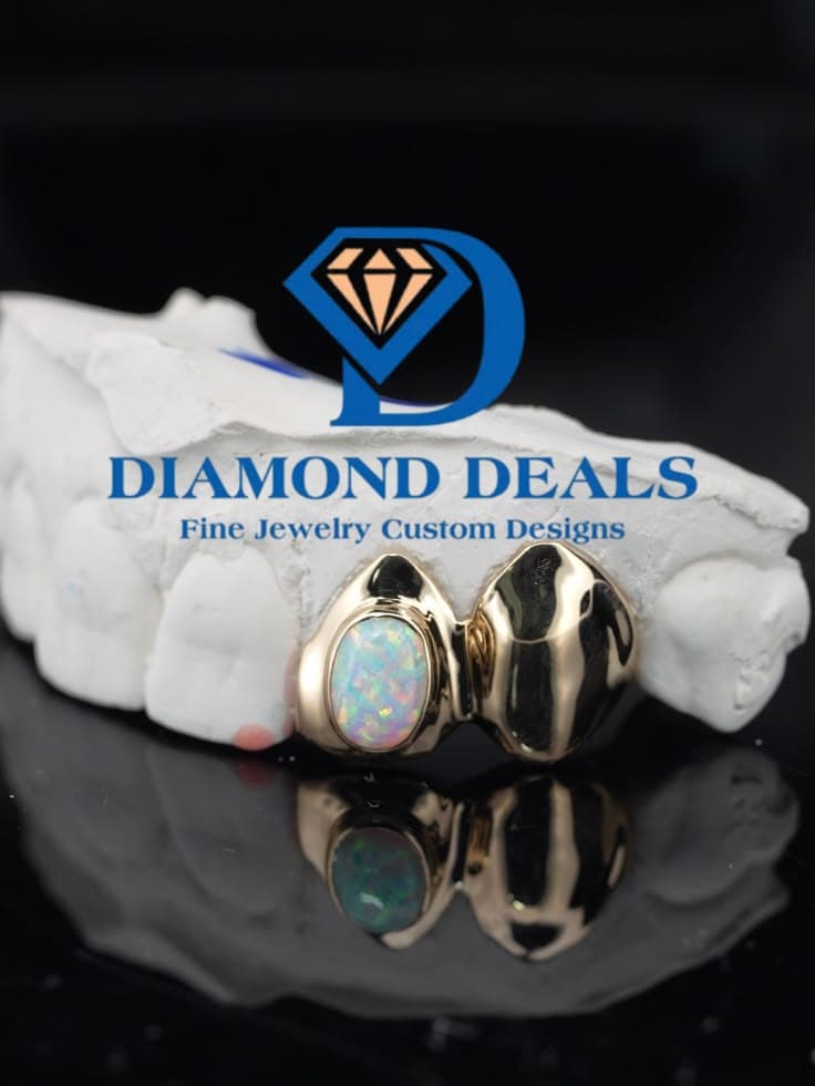 Custom 2 Tooth Yellow Gold Opal Grillz | Solid Gold Opal Tooth Caps