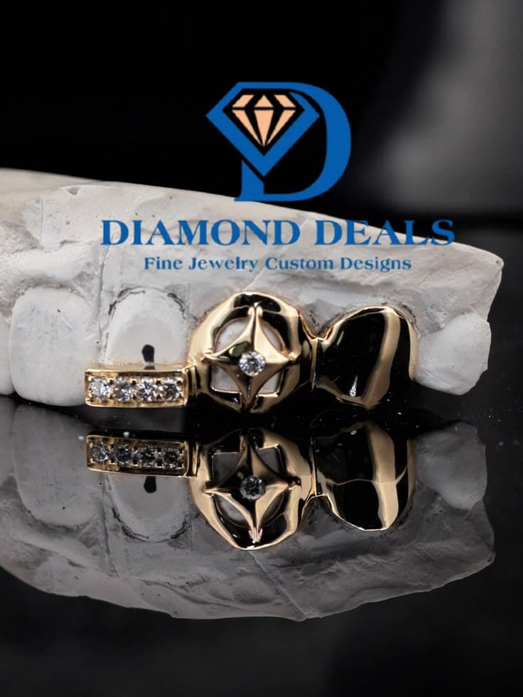 3 Top Custom Rhombus & Diamond Bar Grillz