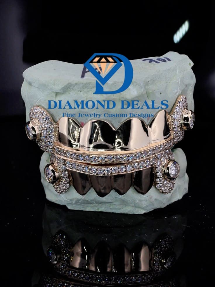 6 Top 6 Bottom Royal Crown Bezel Grillz