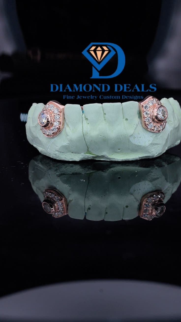 2 Bottom Custom Rose Gold Bezel-Set Accent Grillz