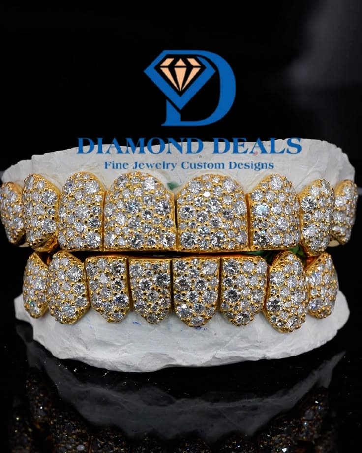 8 Top 8 Bottom Yellow Gold Galaxy Setting Grillz