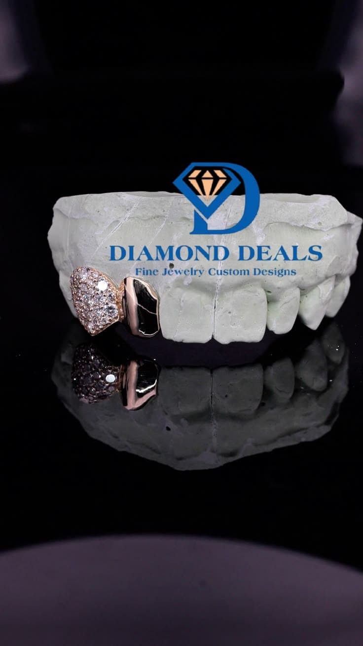 2 Top Custom Diamond-Set Solid Grillz