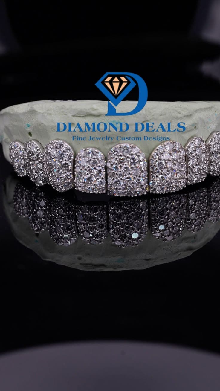 10 Top Galaxy Setting Grillz