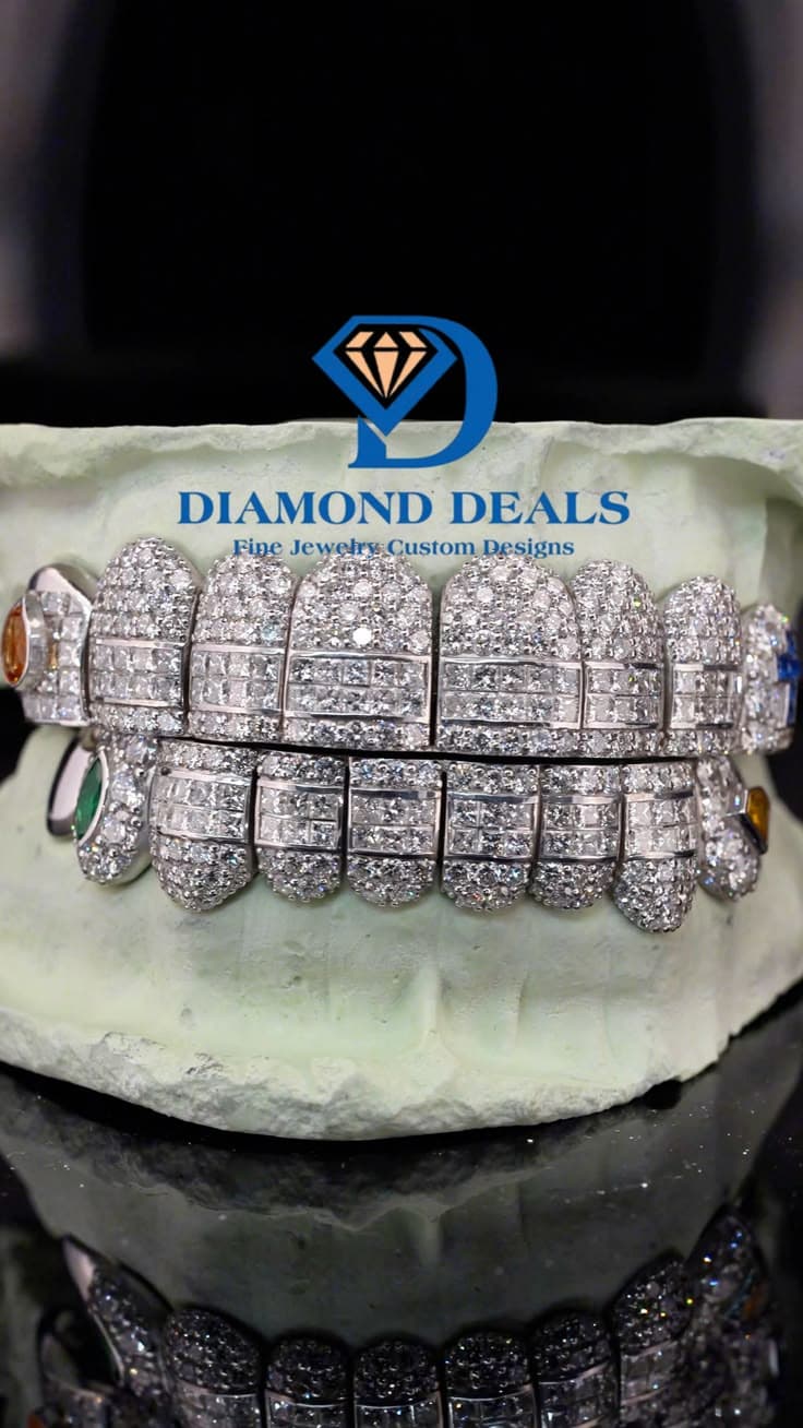 10 Top 10 Bottom White Gold Grillz | Baguette Strip Honeycomb Set with Custom Gemstone Caps