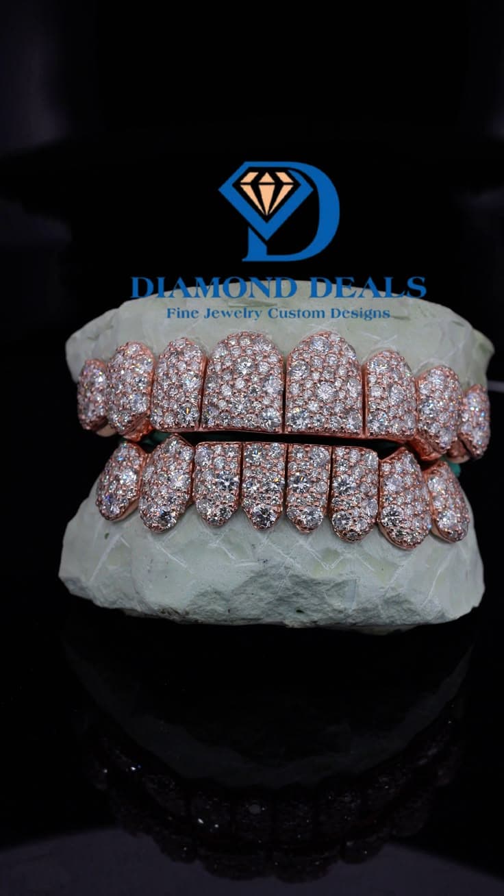 8 Top 8 Bottom Rose Gold Galaxy Grillz Set