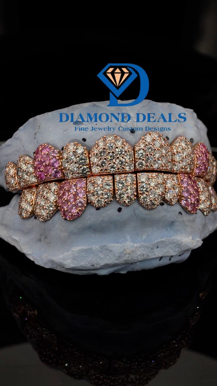 10 Top 10 Bottom with Pink Stone Pavé Grillz