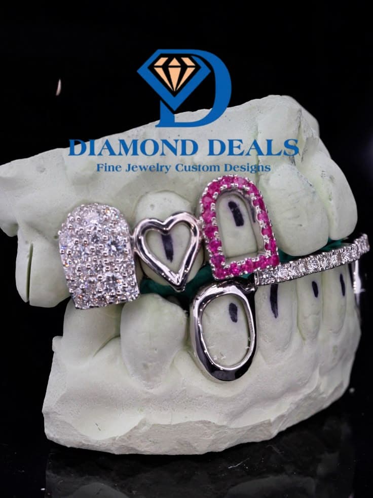 3 Top 2 Bottom Open Face Solid Gold Grillz with Diamond Bar & Pink Sapphire Side Cap