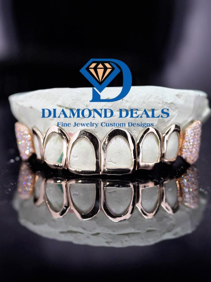 8 Top Open Face Solid Gold Grillz with Honeycomb-Set Side Caps