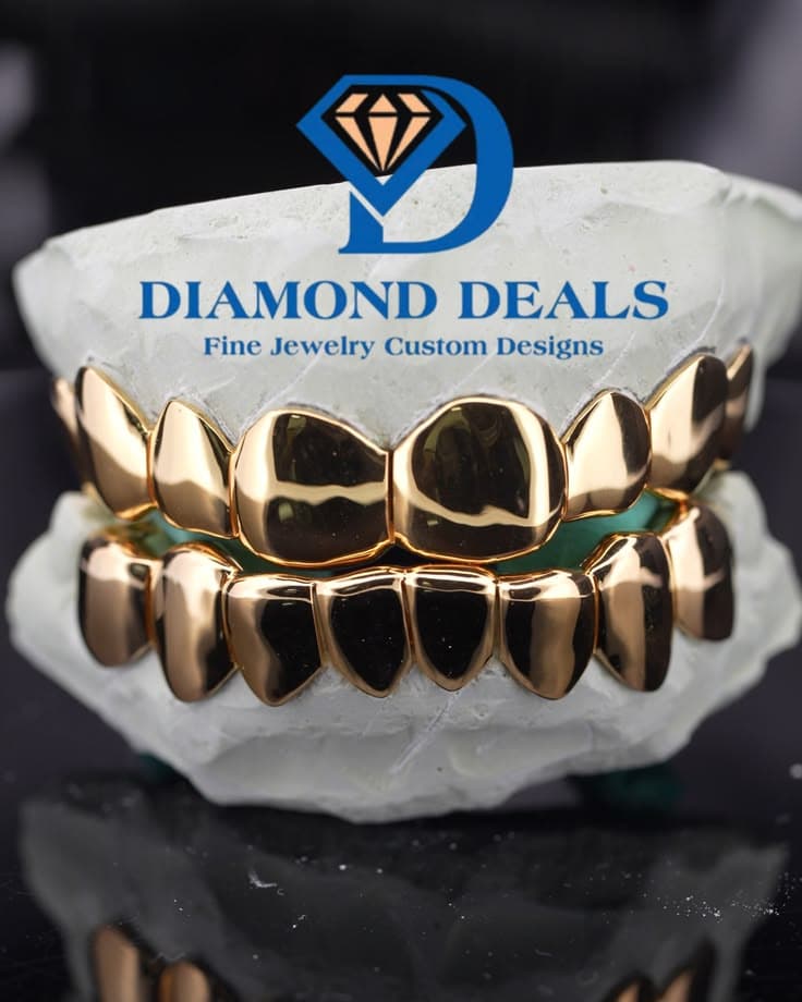 8 Top 8 Bottom Yellow Gold Solid Grillz