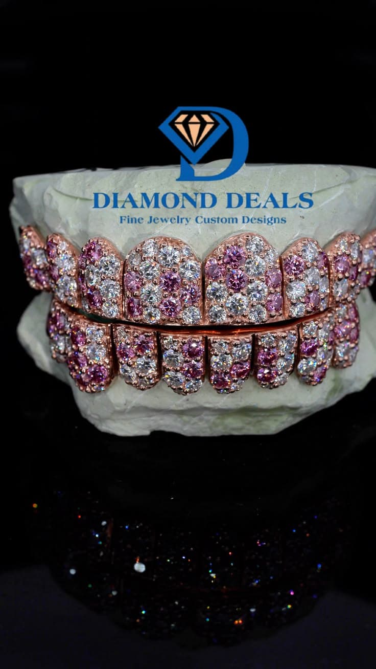 10 Top 10 Bottom Rose Gold Valentine 10pt Jumbo Grillz