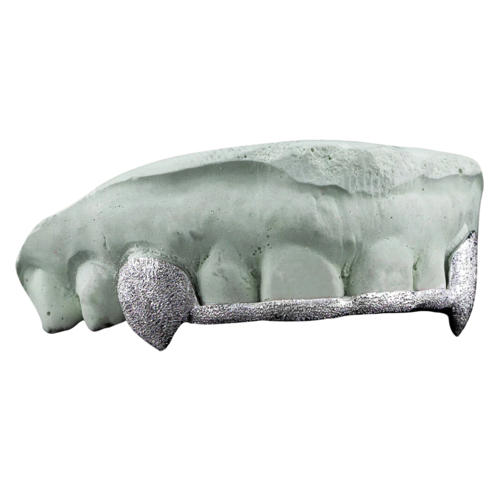 DD52 Solid Gold 6 Teeth with Connecting Bridge Grillz Bar